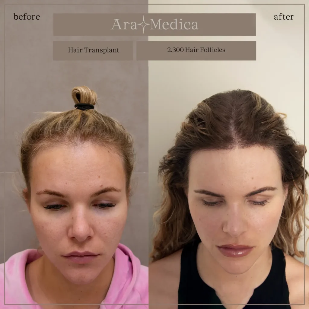 Femminile 1 1536x1536