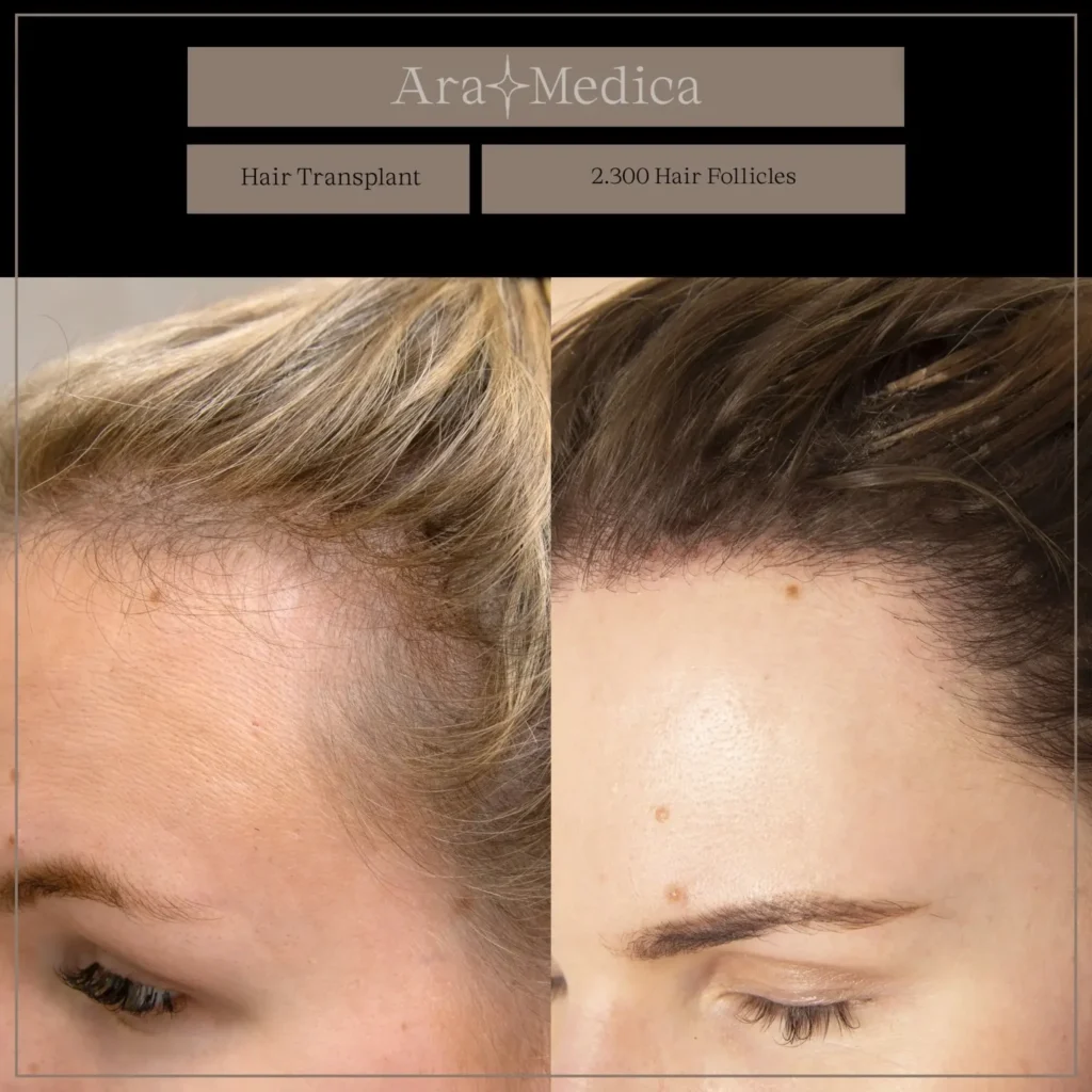 Femminile2 1536x1536