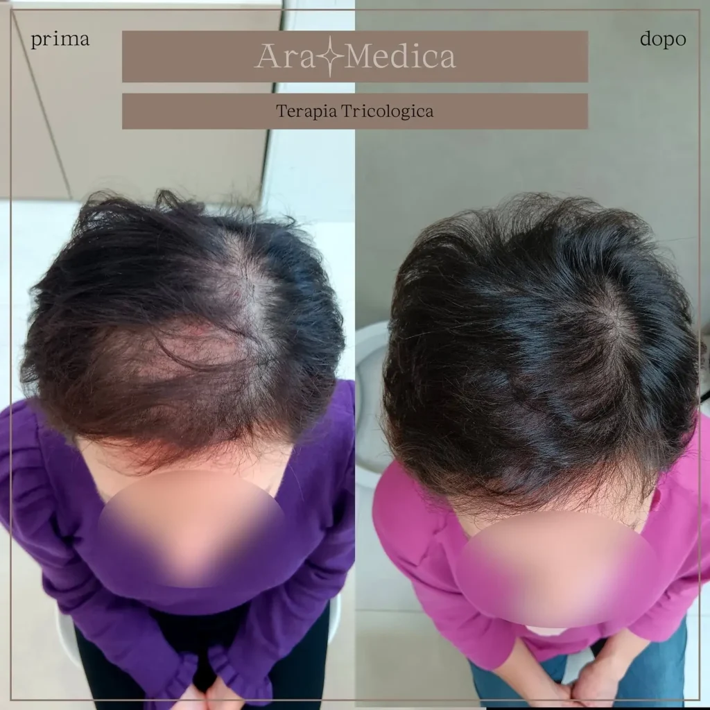 Terapia tricologica2