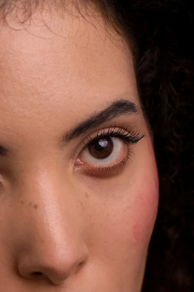 Immagine decorativa per Oculistica