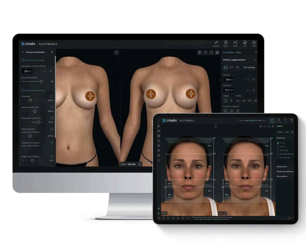 Crisalix aramedica 3d
